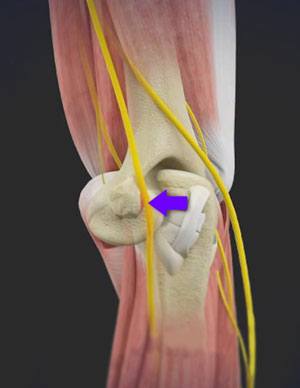 Active Release for the Ulnar Nerve - Active Release Ottawa